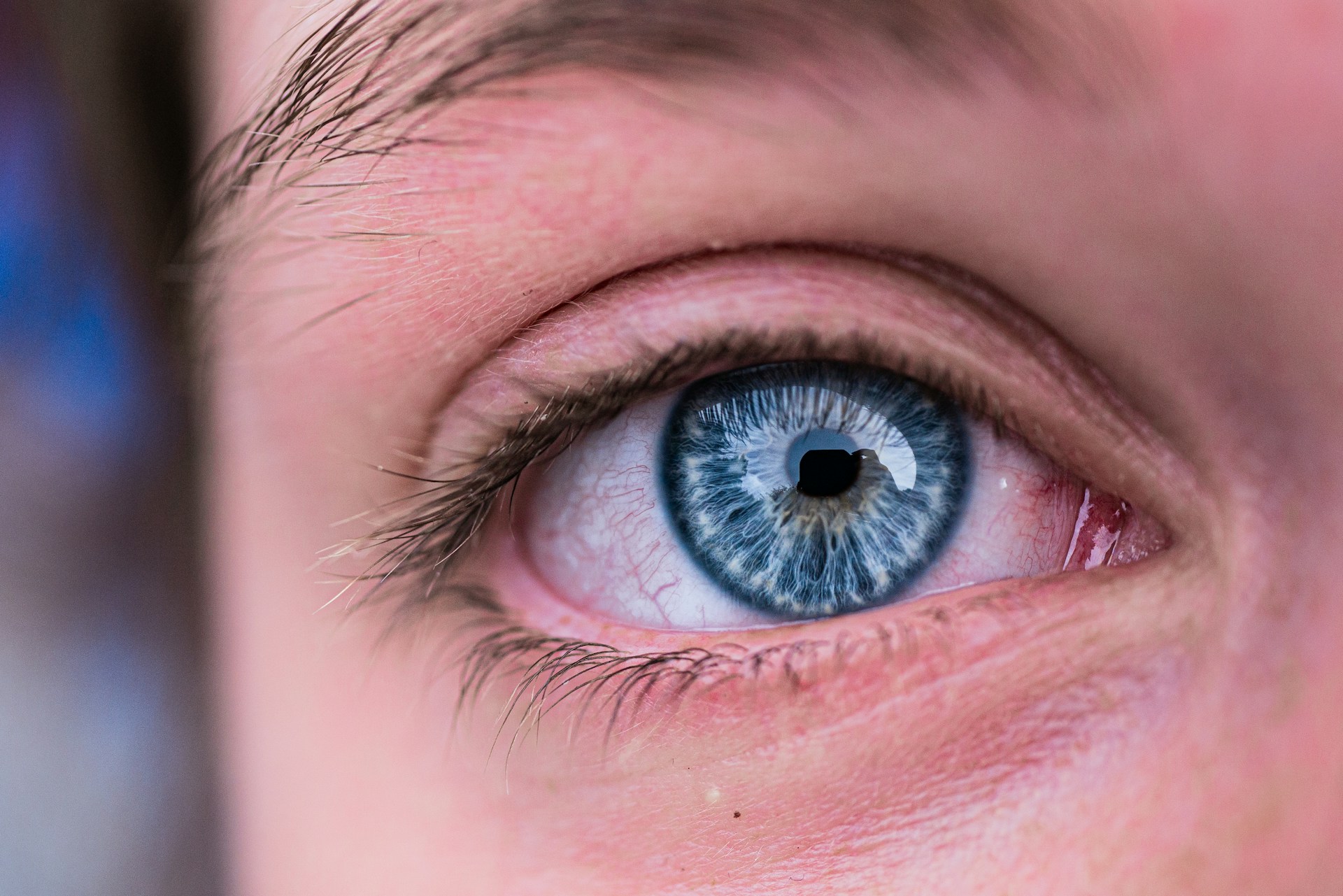 What Is Capsanthin and Why It Matters for Your Eye Health